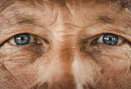 An Overview of the Symptoms in Wet Age-Related Macular Degeneration